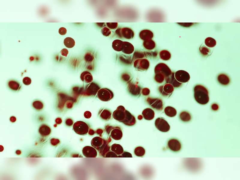 Kasus Penyakit Autoimun di Indonesia Capai 2,5 Juta, Perempuan Usia Produktif Paling Rentan