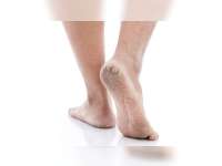 Tips Ampuh Mengatasi Kaki Pecah-Pecah