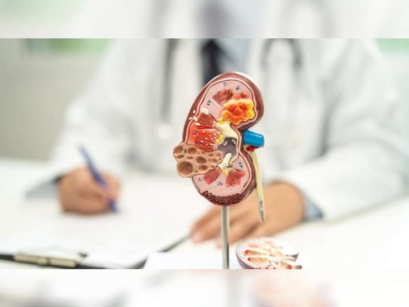 Gejala pada Kanker Ginjal yang Sering Diabaikan Pengidap