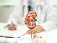 Gejala pada Kanker Ginjal yang Sering Diabaikan Pengidap