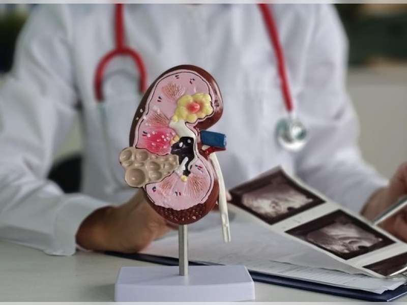 3 Bahan Alami Jaga Kesehatan Ginjal Kita