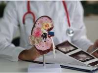 3 Bahan Alami Jaga Kesehatan Ginjal Kita