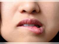 Mekanisme Kerja Pelembab dan Solusi Medis untuk Bibir Kering