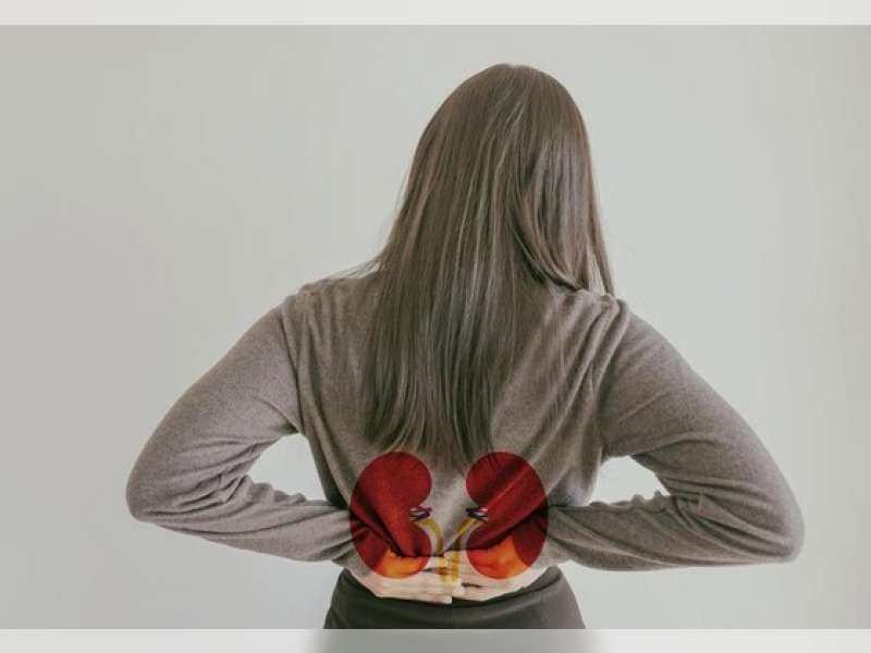 Waspadai Kerusakan Ginjal, Dokter Urologi Ingatkan Risiko Obat Herbal Hingga Vitamin C Berlebihan